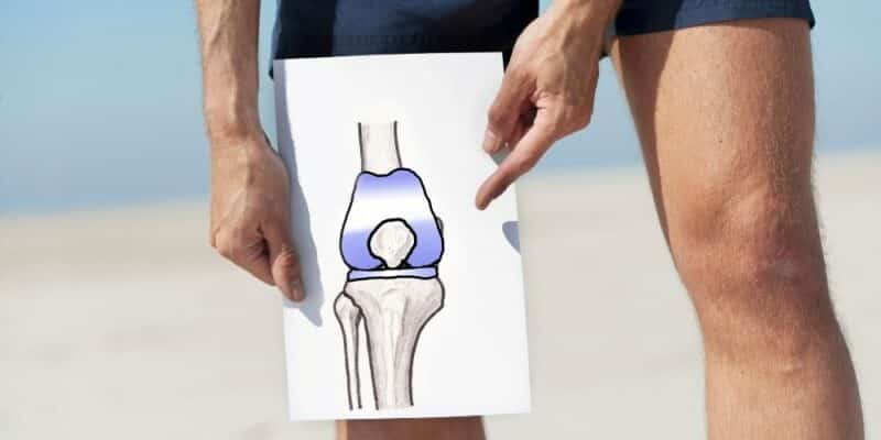 Biaya Operasi Lutut